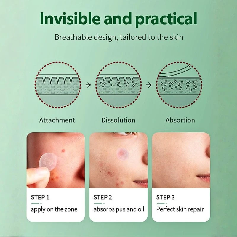 Microneedle acne patch 7 Microneedle acne patch 7